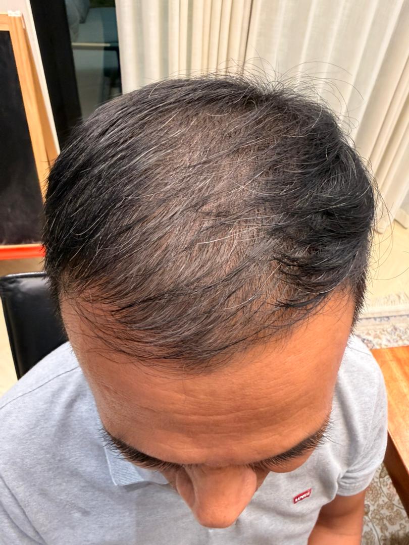 Selepas 6 Minggu